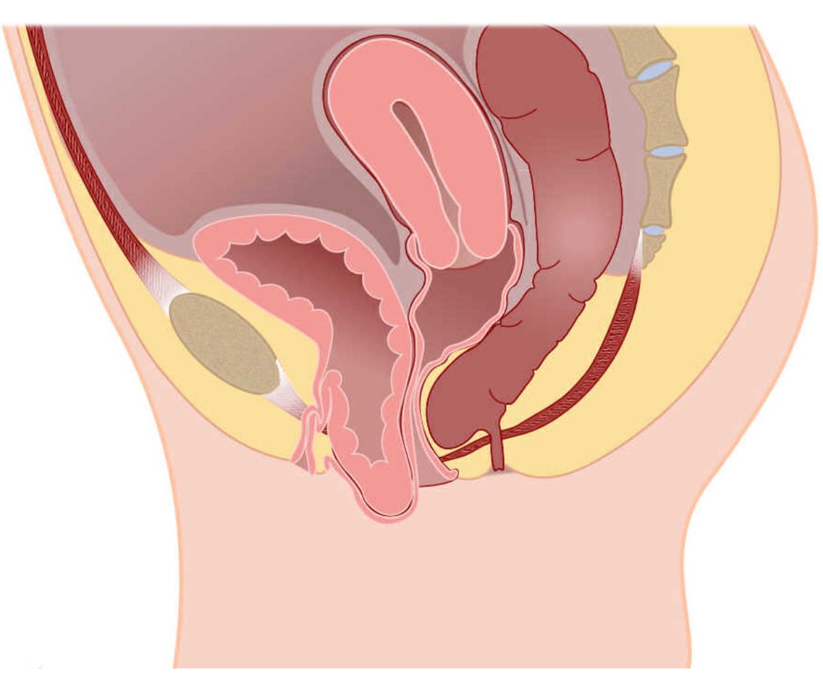 pelvikorgansarkmasi - Op. Dr. Talha Ayvaz