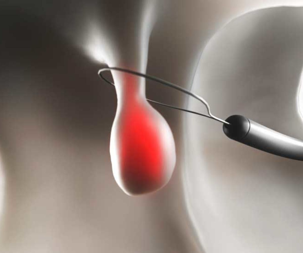 poliptedavisi - Op. Dr. Talha Ayvaz